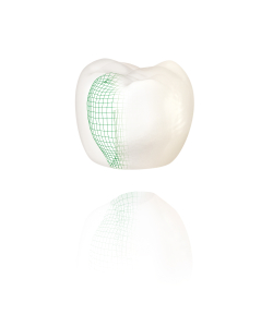 Orthodontie invisible Avesnes sur Helpe - Alignement des dents