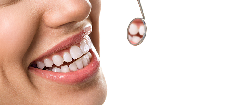 Orthodontie invisible Avesnes sur Helpe - Alignement des dents